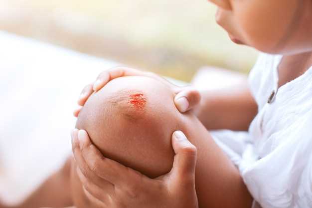 Методы лечения бородавки на пятке у ребенка