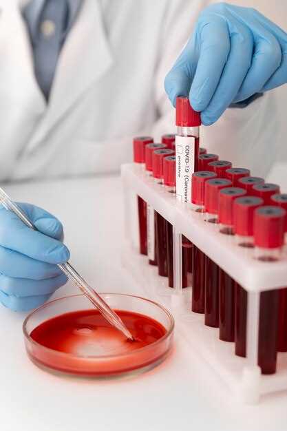 Методы определения вязкости крови