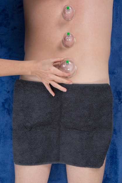 Механизм удаления камней из мочевого пузыря у женщин