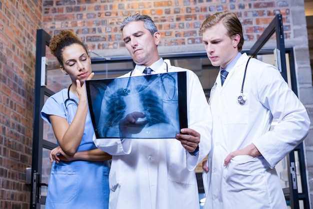 Важность рентгенологического обследования в диагностике воспаления легких