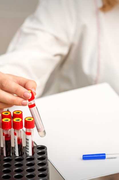 Анализ крови на лейкоциты: что это значит?
