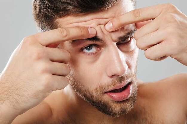 Темные круги под глазами у мужчин: основные факторы и причины
